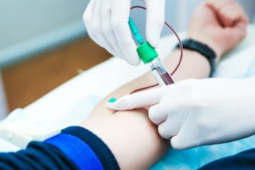 آرمایش خون برای تشخیص تب زرد