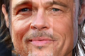 پرد پیت مبتلا به چهره کوری است