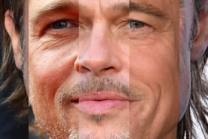 پرد پیت مبتلا به چهره کوری است