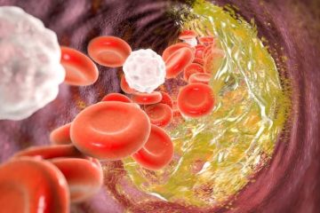 اچ دی ال کلسترول