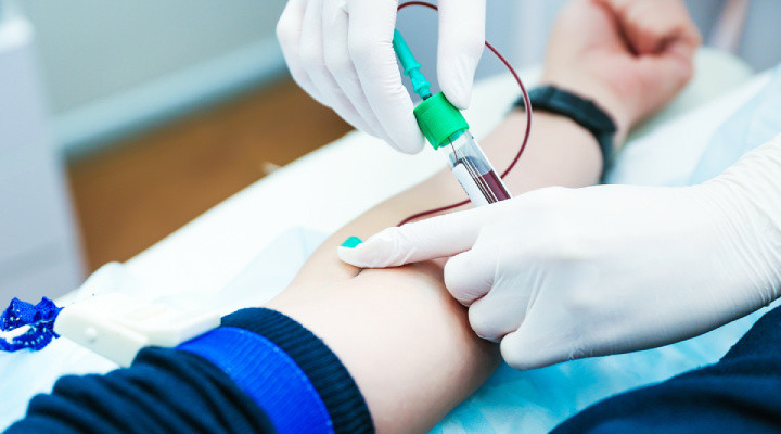 الیگومنوره - آزمایش‌های مربوط به الیگومنوره