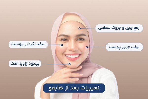 بهترین مارک دستگاه هایفو