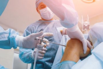 عمل تعویض مفصل زانو