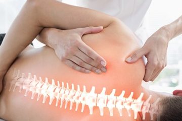 درمان کمردرد ( روش‌های بدون جراحی+ علت‌ها و انواع کمردرد)